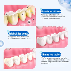 Bande de Blanchiment Dentaire 5D White™ Originale | Transformez Votre Sourire en Seulement 7 Jours [50% de Réduction + Livraison Gratuite UNIQUEMENT AUJOURD’HUI]