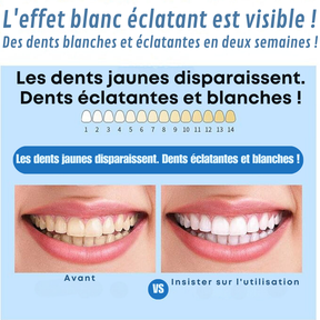 Bande de Blanchiment Dentaire 5D White™ Originale | Transformez Votre Sourire en Seulement 7 Jours [50% de Réduction + Livraison Gratuite UNIQUEMENT AUJOURD’HUI]