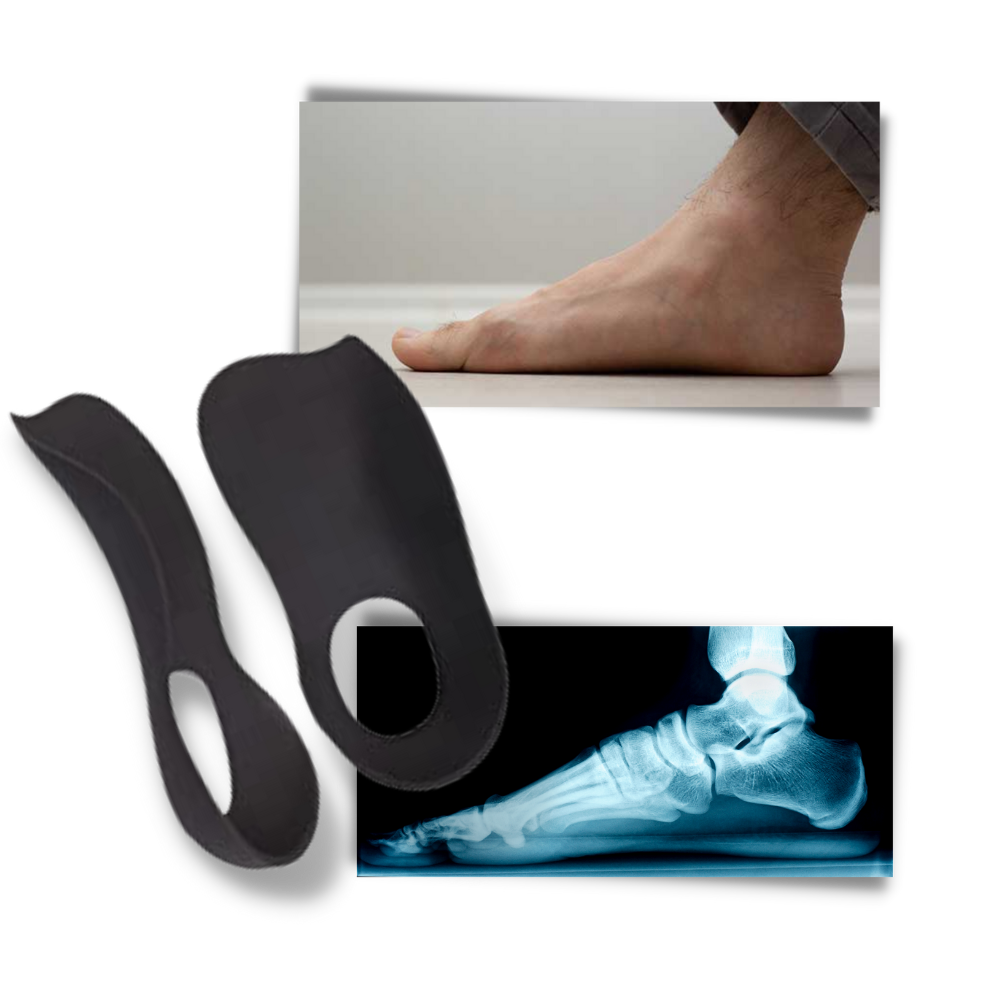 Semelles orthopédiques pour pieds plats