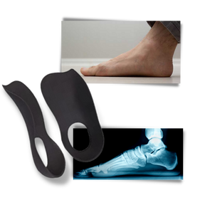 Semelles orthopédiques pour pieds plats