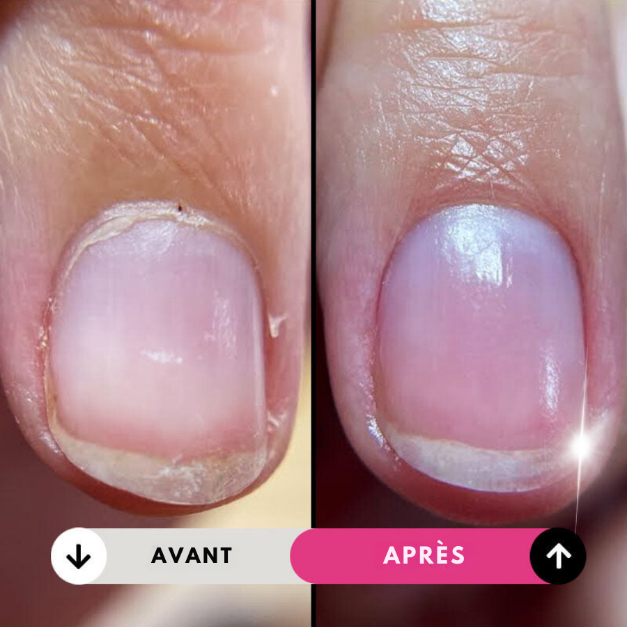 Lime à Ongles Électrique Professionnelle 5 en 1 Sans Fil Megapen