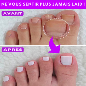 Lime à Ongles Électrique Professionnelle 5 en 1 Sans Fil Megapen