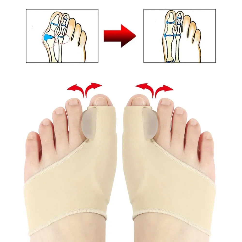 Orthèses Hallux Valgus - Correcteur Hallux Valgus - Redresseur Orteil - Pack de 2